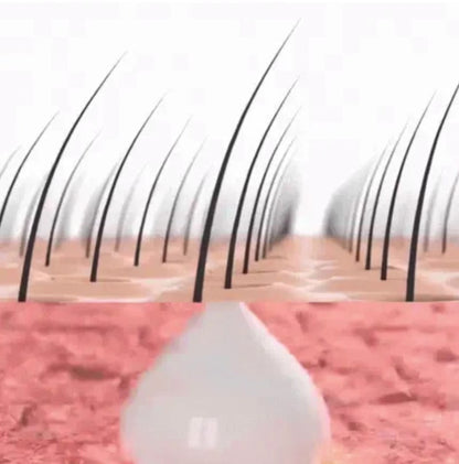 Micro-infusion capillaire régénérante Nuricia®