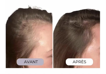 Micro-infusion capillaire régénérante Nuricia®